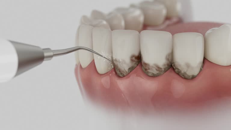 Reliable Dental Implants contractor in Minerva, OH by Smile Center Dentistry